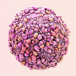 breast cancer cell