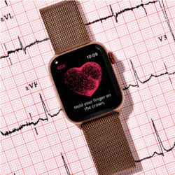 EKG on Apple Watch