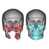 3D Technology Revolutionizing Face Transplants