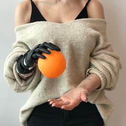 A Motorica hand prosthetic.