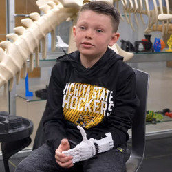 Chase Rawlings with 3D-printed hand