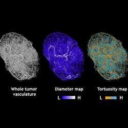 Maps of tumors grown in mice.