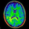 From One Brain Scan, More Information for Medical AI