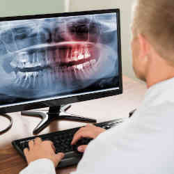 Reviewing dental x-rays for signs of decay or disease.
