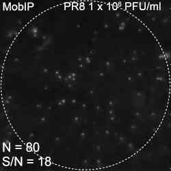 Images of viruses caught on the smartphone rig.