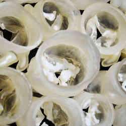 Multi-material physical models of patients aortic heart valves, each with its own unique size, shape, and amount of calcification.