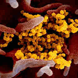 The coronavirus (in yellow). 