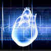 'Smart' Devices Help Reduce Adverse Outcomes of Common Heart Condition