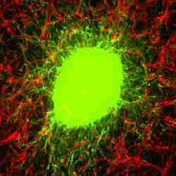 Glioblastoma Stem Cell