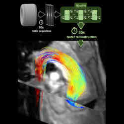 The new method makes it possible to obtain precise MRI images of blood flow in a sixth the time it takes now.