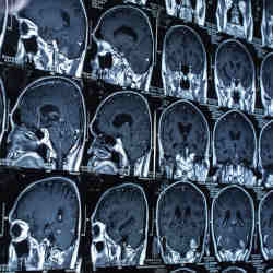 Brain scans. 