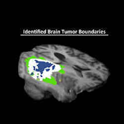 Distinguishing tumors from healthy brain tissue.