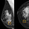 Google's Breast Cancer-Predicting AI Research Is Useless Without Transparency, Critics Say