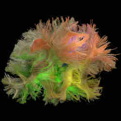 A human brain with its fibers showing its immense complexity.