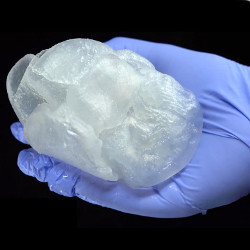 3D bioprinted heart