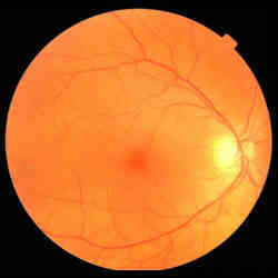 An example of a fundus eye image taken from the UK Biobank. 