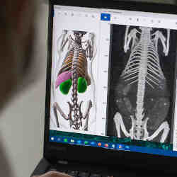 The software is able to recognize bones and organs on three-dimensional grayscale images, and segment them