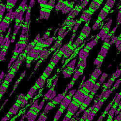 Denoised imaging of bands in mouse heart muscle. 