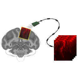 The researchers slotted a small ultrasound transducer, roughly the size and shape of a domino, into the skull of each monkey. 