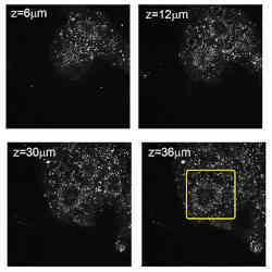 An organoid growing in a microfluidic bioreactor.