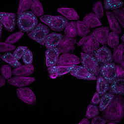 Fluorescence microscopy image of protein condensates forming inside living cells.