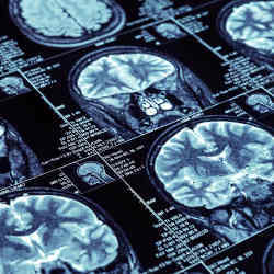 Comparing brain scans.