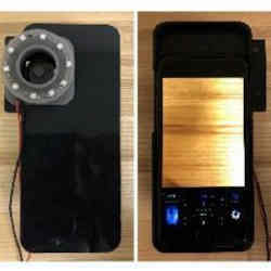 The modified smartphone used to capture LED-illuminated RGB images of skin and oral cavities.