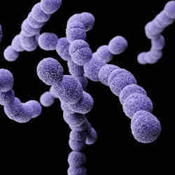 Group-B Streptococcus, a type of bacteria that can cause severe illnesses such as sepsis.