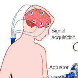 A brain-computer interface device connecting to a subject's brain.