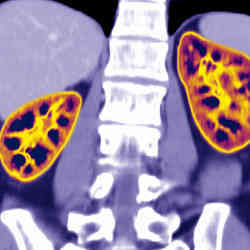 Image from a kidney scan.