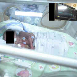 A baby in Flinders Medical Centre's intensive care neonatal unit.