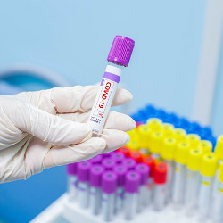 coronavirus blood test tube