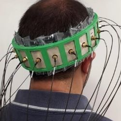 A photo of a man wearing a specialized device on his head to detect the presence of stroke.