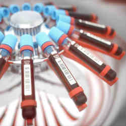 Blood tests in a centrifuge.