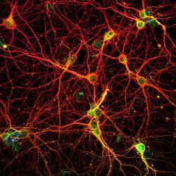 Neurons in a mouse brain.