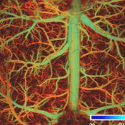 The vasculature of the brain.