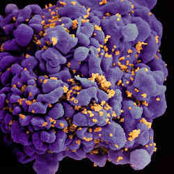 A human H9 T cell infected by HIV.