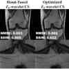 Researchers Combine Data Science, ML Techniques to Improve Traditional MRI Image Reconstruction