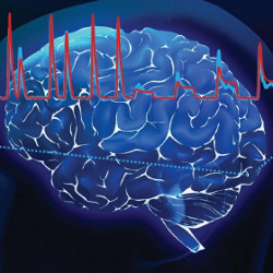 representation of neural activity fluctuations in the human visual cortex