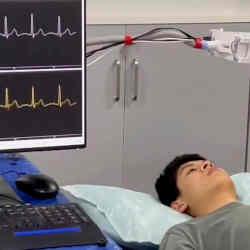 The researchers demonstrated an experimental setup for contactless ECG monitoring using millimeter-wave radar.