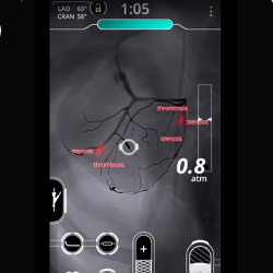 screenshot of Level Ex video game for cardiologists