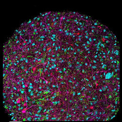 a magnified image of a lab-grown brain organoid