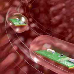 Artist's conception of wireless devices moving through the gastrointestinal tract. 