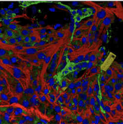 The nanoelectronic sensors (yellow, blue) are embedded with natural tissues (red, green). 