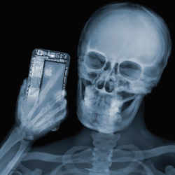 X-ray image of a person using their iPhone. 