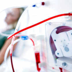 Hemodialysis is a vital procedure for people with kidney failure, but it requires multiple lengthy clinic visits every week.