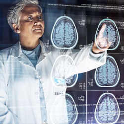 A doctor reviews brain scan images.