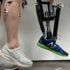 Robotic Prosthetic Ankles Improve 'Natural' Movement, Stability