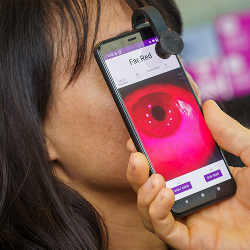 The technology uses far-red light to capture clear video of the pupil in dark eye colors.