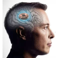 An image of Elon Musk with a brain chip.